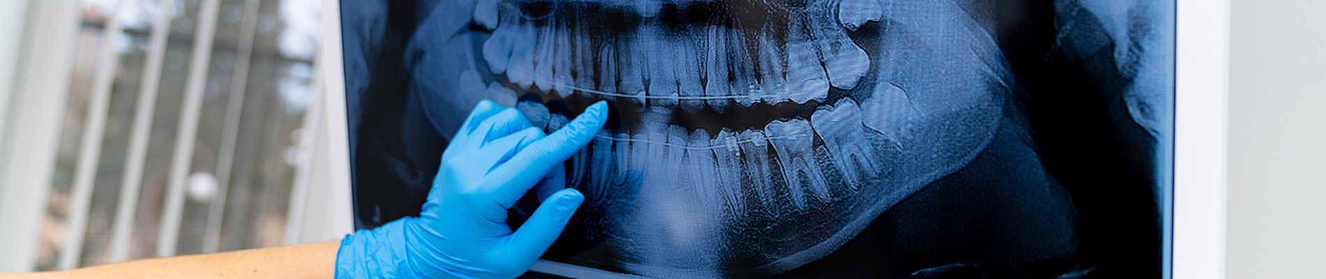 A person is seated in a dental chair, receiving care from a dental professional who stands behind them.