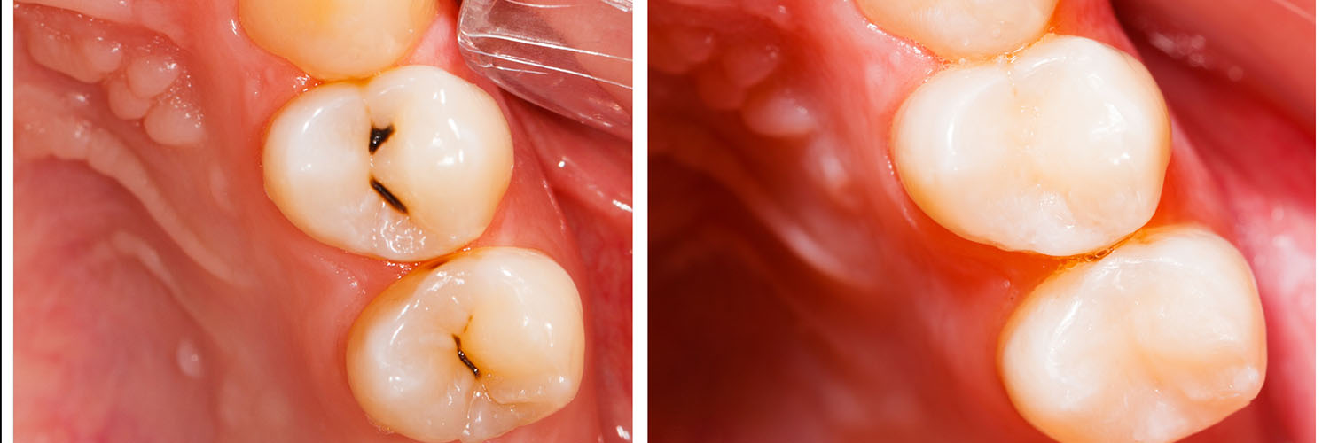 AMS Dental